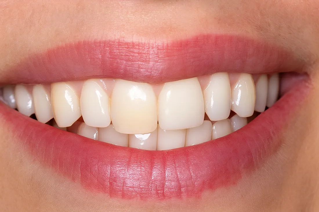 aesthetische-zahnmedizin-dr-tischler